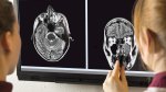 Brain-Scan-Health-Observation
