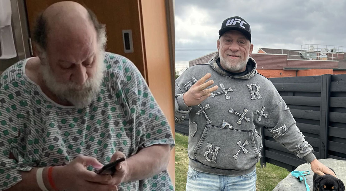 Ufc Fight Mark Coleman before and after his hospitilization from a house fire